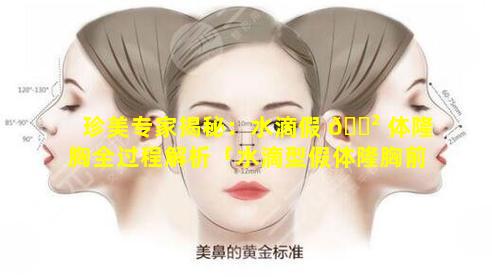 珍美专家揭秘：水滴假 🌲 体隆胸全过程解析「水滴型假体隆胸前后对比效果图片和手术过程分 🌺 享_珍美」